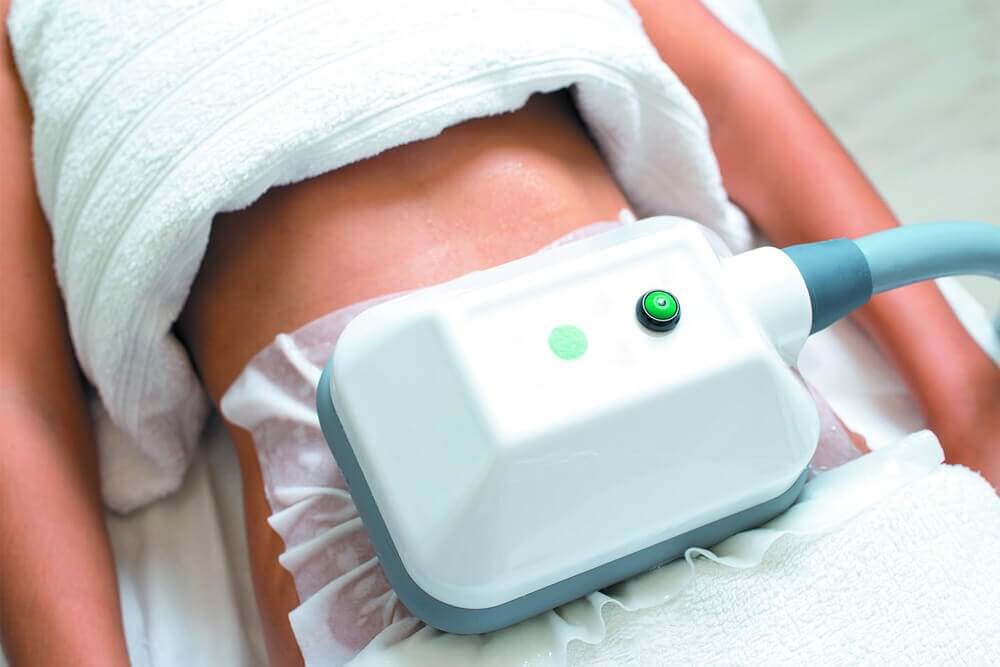 Top 5 Reasons of Why Men Choose Coolsculpting
