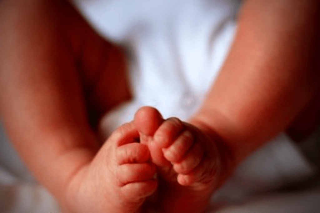 Clubfoot correction in Children - Can It be Easily Corrected?